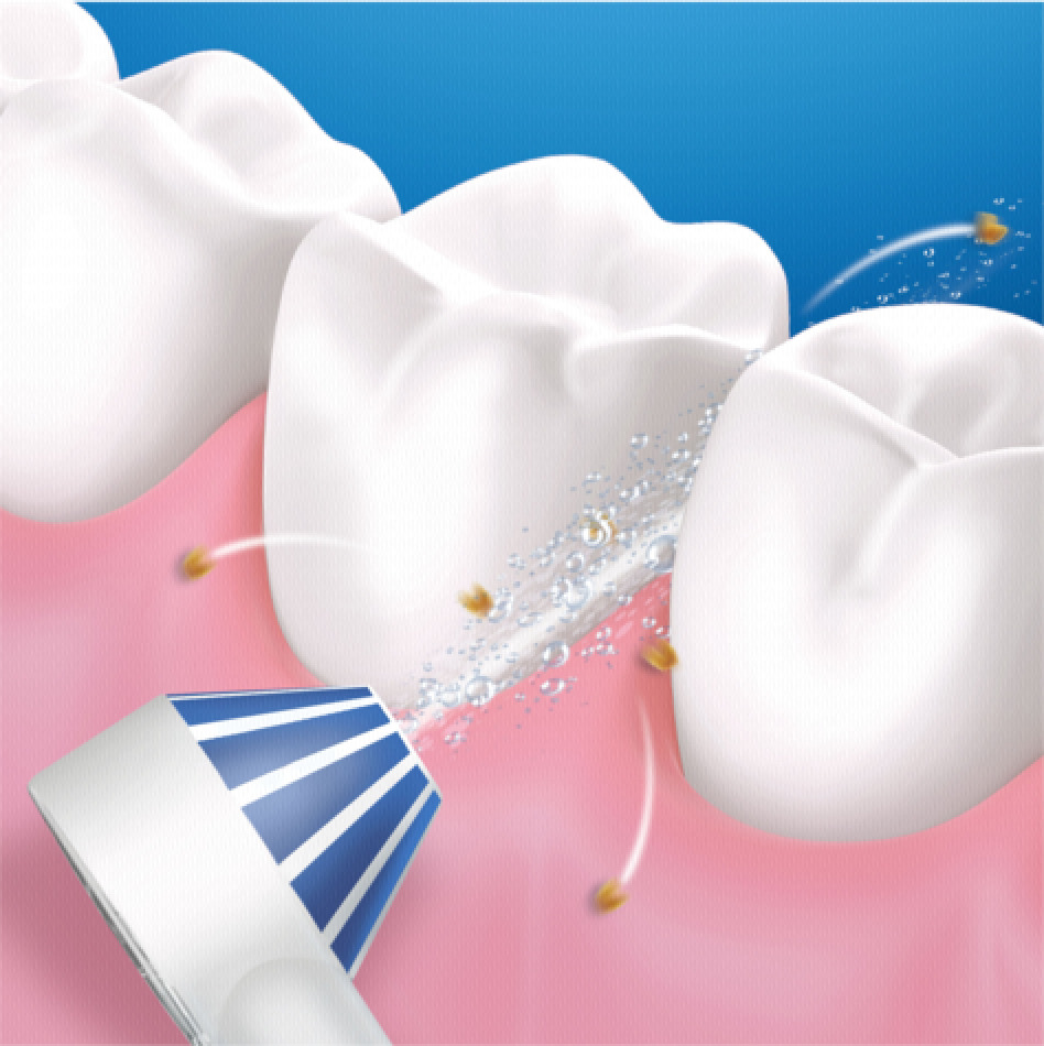 20190822113101_6ff4d1d5 Oral-B AquaCare 4 - Image 6