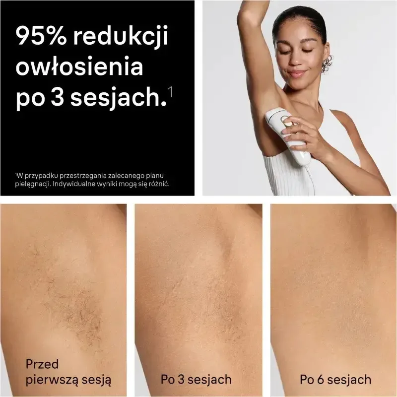 20260224125001_9231e522 Braun Silk·expert Pro 5 Αποτριχωτική Μηχανή IPL για Πρόσωπο & Μπικίνι PL5210 - Image 1